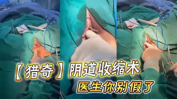 【猎奇】阴道收缩术，医生你别假了