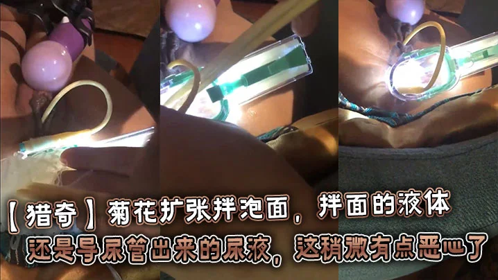 【猎奇】菊花扩张拌泡面，拌面的液体还是导尿管出来的尿液，这稍微有点恶心了